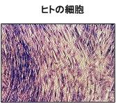 blogPhoto